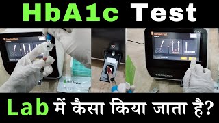 HbA1c Test Procedure HbA1c Test in Hindi  Glycosylated Hemoglobin  Lab Practical  DMLT  BMLT [upl. by Pacian]