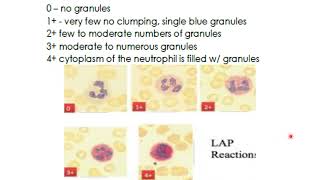 HEMA1 Myeloproliferative Disorders [upl. by Enttirb]