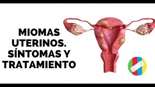 MIOMAS UTERINOS Síntomas y Tratamiento [upl. by Enella]