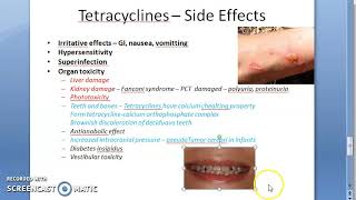 Pharmacology 733 c Tetracyclines Adverse Effect ADR Reaction Fanconi Syndrome Children Teeth [upl. by Faucher]