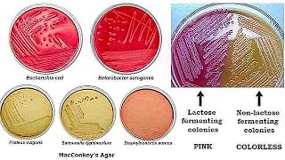 MacConkey Agar [upl. by Opiak]