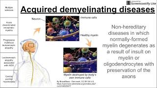 Acquired demyelinating diseases [upl. by Shellans379]