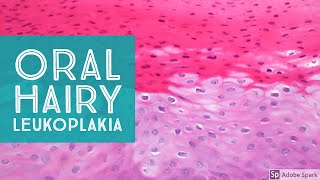 Oral Hairy LeukoplakiaExplained by a Dermatopathologist [upl. by Ainirtak]