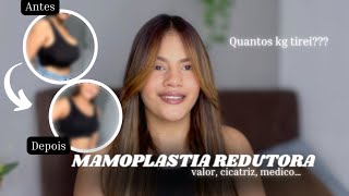 TUDO SOBRE MINHA MAMOPLASTIA REDUTORA COM VÍDEO DE ANTES E DEPOIS [upl. by Manolo]