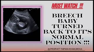 Successful Reorientation of Breech Baby to Normal Position  Prophet Tapiwa Nyamurova [upl. by Roxane699]