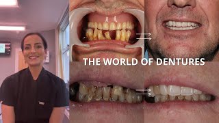 Lets Delve Into The World Of Dentures [upl. by Lokkin]