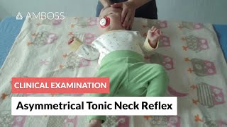 Asymmetrical Tonic Neck Reflex  Clinical Examination [upl. by Alimac]