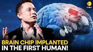 Elon Musks Chip Implant Neuralink second human experiment [upl. by Cassell]