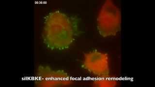 Dynamic focal adhesions [upl. by Crenshaw]