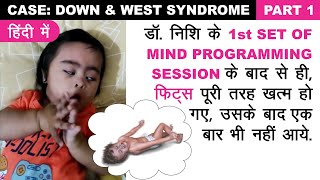 200 SEIZURES पूरी तरह ख़त्म हो गएडॉनिशी भट्ट के एक ही सेशन के बाद CaseDownamp West Syndrome Part 1 [upl. by Babita]