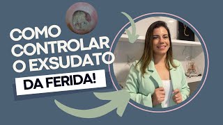 COMO CONTROLAR O EXSUDATO DA FERIDA [upl. by Enelak326]