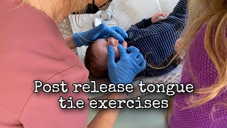 Tongue tie post release stretches and exercises [upl. by Pavier]