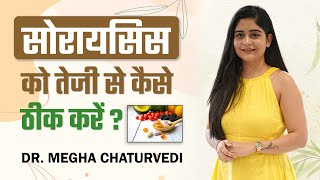 Psoriasis को तेजी से ठीक कैसे करें   Tips for Fast Psoriasis Recovery  Dr Megha Chaturvedi [upl. by Allemahs224]