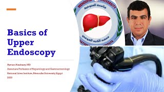 Basics Of Diagnostic Esophagogastroduodenoscopy EGD [upl. by Eanod]