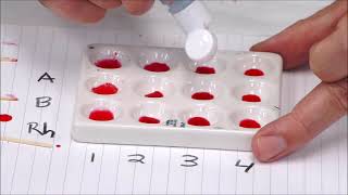 Blood Typing Activity [upl. by Ive]