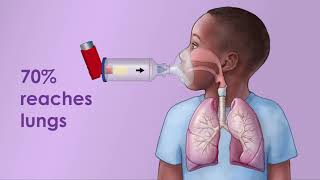 Asthma Inhaler with Spacer [upl. by Yankee]