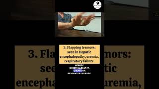 10 Important abnormal movements imp for exams neurology neetpg internalmedicine [upl. by Loydie]