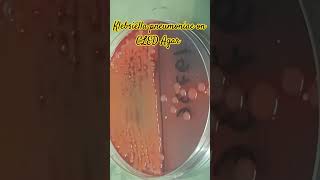 Klebsiella pneumoniae colony morphology on CLED agar of Urine Culture [upl. by Alliuqaj138]