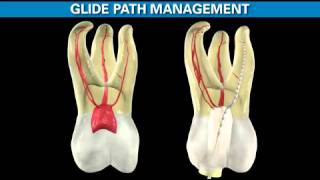 ProTaper Gold  Shaping the Future of Endodontics  Dentsply Sirona [upl. by Sine]