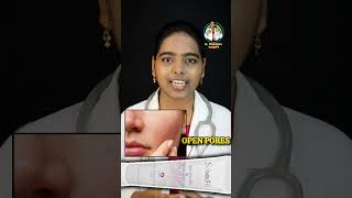 Oiliness Pimples Open pores Skin Tan Best 4 Creams  telugu homelytips doctor [upl. by Eltsirhc]