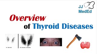 Overview of Thyroid Diseases Hashimoto’s Graves’ Sick Euthyroid Syndrome Toxic adenoma etc [upl. by Yrdua]