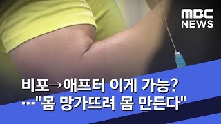 비포→애프터 이게 가능…quot몸 망가뜨려 몸 만든다quot 20190404뉴스데스크MBC [upl. by Atiugram]