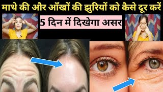 How To Remove Forehead amp Eye Wrinkles ❓️माथे और आंखों की झुर्रियां 5 दिन में गायब करने का सरल तरीका [upl. by Schertz]