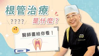 根管治療是什麼？蛀牙到什麼程度會需要做根管治療呢？｜美齒知識EP26｜玩美爵品牙醫診所 陳忠明醫師 [upl. by Crespi]