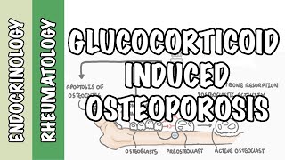 Glucocorticoid Induced Osteoporosis and Fractures  mechanism and pathophysiology of fractures [upl. by Dibrin]