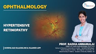 Ophthalmology  Hypertensive retinopathy  Raaonline [upl. by Mariska50]