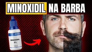 COMO USAR MINOXIDIL PARA TER MAIS BARBA [upl. by Nic]