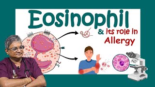 ইওসিনোফিল কি Why Eosinophils are SO Important for Your Body Role of eosinophils in allergy [upl. by Noirret924]