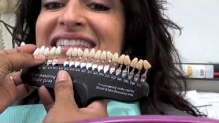 Teeth Whitening in the Salon to Make more Money [upl. by Lalo308]