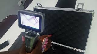 Video Laryngoscope Demonstration [upl. by Johnette]