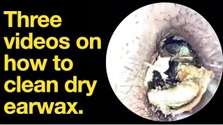 Three videos on how to clean dry earwax ear wax removal  ear cleaning  ASMR  relaxation  relax [upl. by Blandina465]