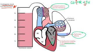 Shock for the USMLE Step 1 [upl. by Eneres]