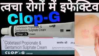 CLOPG Cream Uses in Hindi  Clobetasol Propionate amp Gentamicin Sulphate Cream [upl. by Adnulahs]