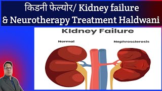 Cure kidney Failure  Kidney Problem amp Neurotherapy Treatment Haldwani UK 9990353860 [upl. by Utas]