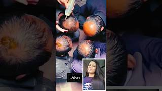 🔥Best Hair Growth Oil For Faster Hair Growth Hair Growth Tips 💯 shorts hairoil haircare viral [upl. by Nerti558]