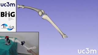 Knee joint goniometry using MARG lowcost sensors [upl. by Akiria]