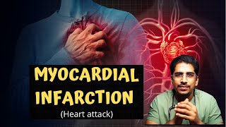 MYOCARDIAL INFARCTION MI  Heart attack in 20mins [upl. by Aileme]