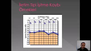 İşitme Kayıp Tipleri ve Odyogram Yorumlama Teknikleri [upl. by Aline]