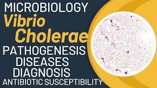 Vibrio cholerae cholera  Vibrio cholerae microbiology  Pathogenesis lab diagnosis [upl. by Lehcir]