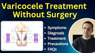 Varicocele  Symptoms Diagnostic Best Treatment FAQ  Dr Gaurav Gangwani IR [upl. by Ladin]