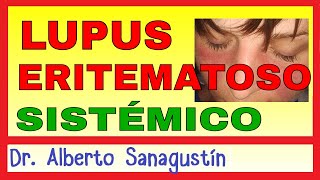 LUPUS ERITEMATOSO SISTÉMICO LES Síntomas Fisiopatología y Tratamiento [upl. by Callista]