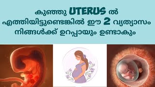 Early Pregnancy Symptoms Deechus world Malayalam [upl. by Yelnik]