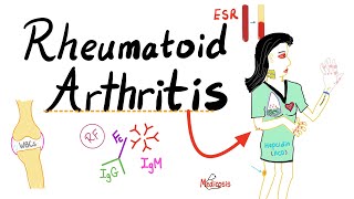 Rheumatoid Arthritis RA  Autoimmune Disease  Definition Etiologyamp Epidemiology  Rheumatology [upl. by Aivirt]