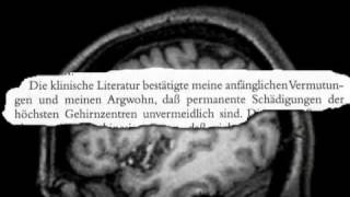 Verringerung der intellektuellen Fähigkeiten durch neuroleptische Behandlung [upl. by Molli859]