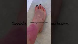 Kim Kardashian Unintentional ASMR  Softspoken asmr kimkardashian psoriasis [upl. by Pelagi]