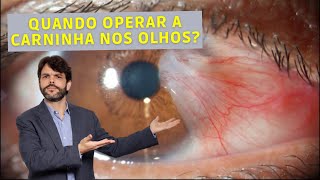 Quando operar a carninha nos olhos  Dr João Paulo Lomelino [upl. by Ennovoj428]